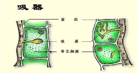 吸器