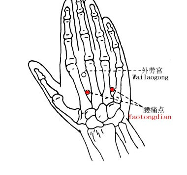 什么是腰痛穴