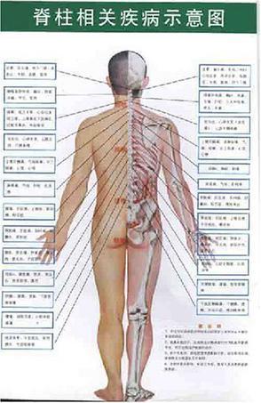 脊柱相关疾病示意图