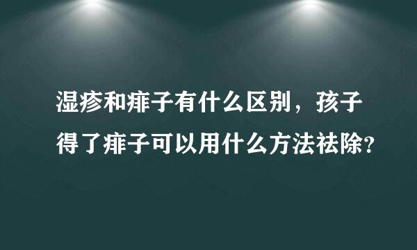 湿疹和痱子有什么区别，孩子得了痱子可以用什么方法祛除？