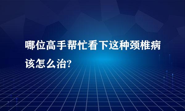 哪位高手帮忙看下这种颈椎病该怎么治?