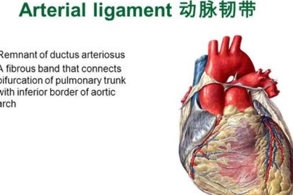 动脉韧带与动脉导管区别