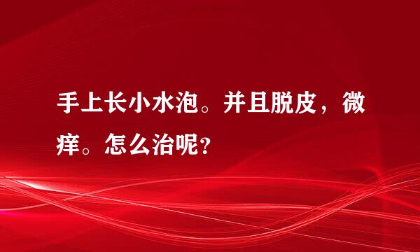 手上长小水泡。并且脱皮，微痒。怎么治呢？