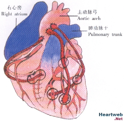 中央2套 健康之路 哪一期主持了一档心脏搭桥手术啊一个晋医生帮一个中年女人做的手术。 ？？急、