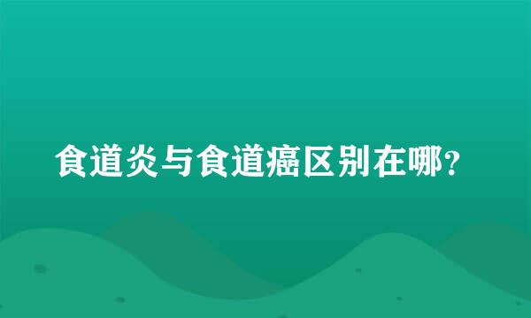 食道炎与食道癌区别在哪？