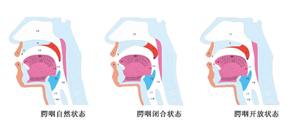 鼻音重怎么办