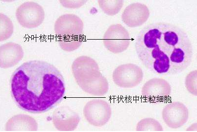 体检中性粒细胞百分率增高是怎么回事