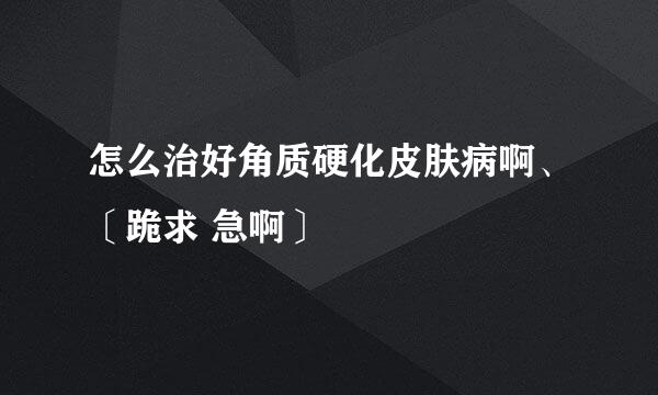 怎么治好角质硬化皮肤病啊、〔跪求 急啊〕