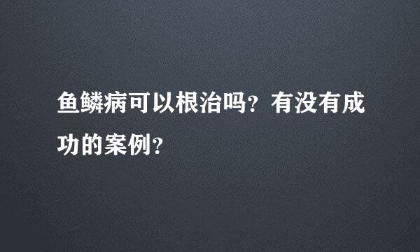 鱼鳞病可以根治吗？有没有成功的案例？