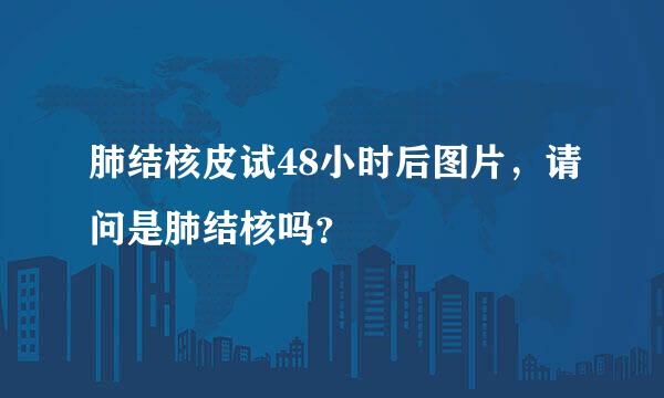 肺结核皮试48小时后图片，请问是肺结核吗？