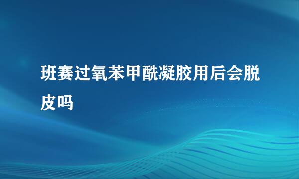 班赛过氧苯甲酰凝胶用后会脱皮吗