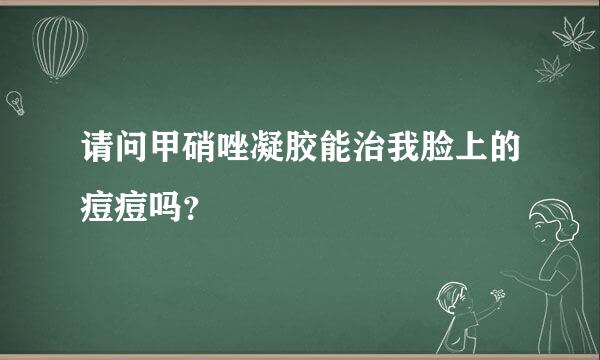 请问甲硝唑凝胶能治我脸上的痘痘吗？