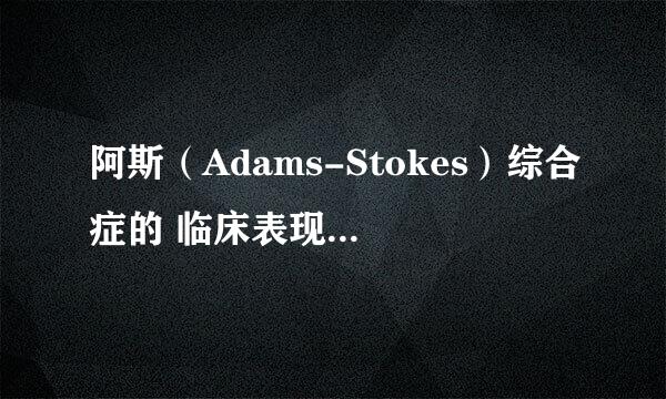 阿斯（Adams-Stokes）综合症的 临床表现、诊断与鉴别诊断、治疗