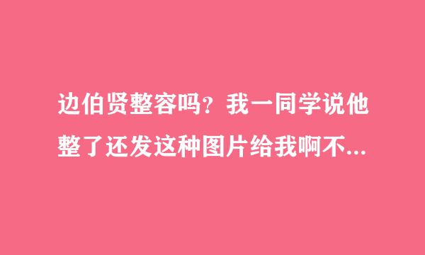 边伯贤整容吗？我一同学说他整了还发这种图片给我啊不是白白啊