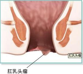 男性hpv58阳性是什么意思