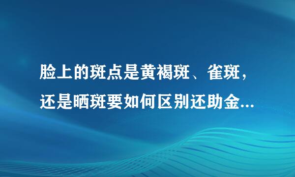 脸上的斑点是黄褐斑、雀斑，还是晒斑要如何区别还助金故延火广度