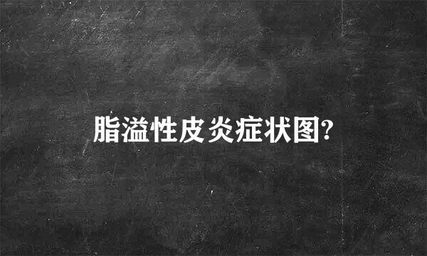 脂溢性皮炎症状图?