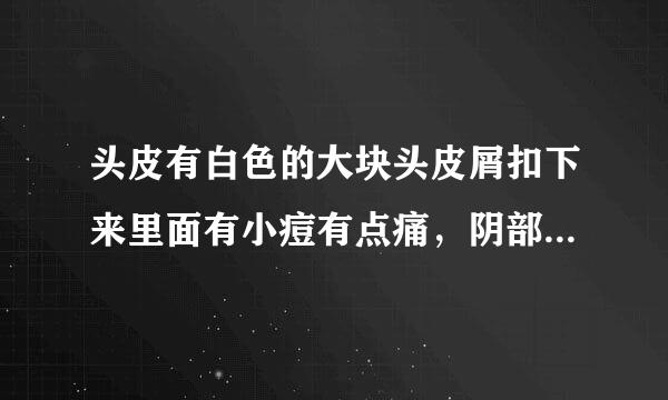 头皮有白色的大块头皮屑扣下来里面有小痘有点痛，阴部...