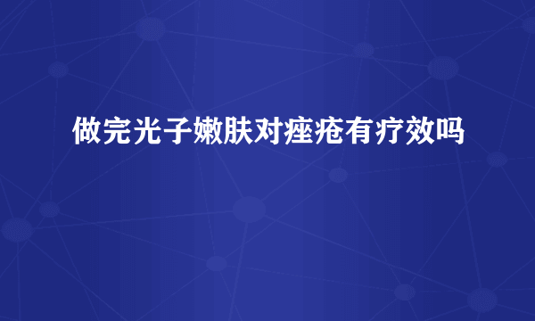 做完光子嫩肤对痤疮有疗效吗