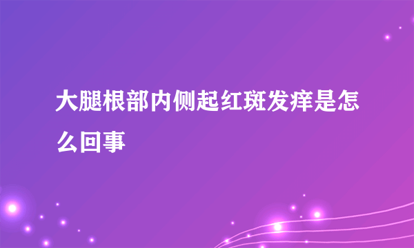 大腿根部内侧起红斑发痒是怎么回事