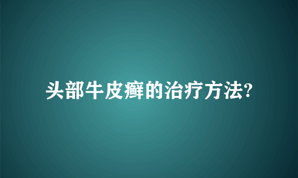 头部牛皮癣的治疗方法?