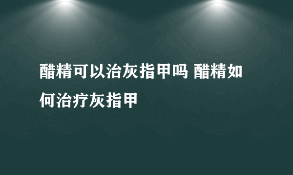 醋精可以治灰指甲吗 醋精如何治疗灰指甲