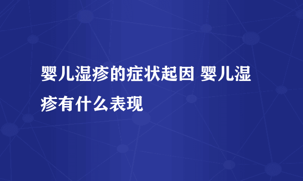 婴儿湿疹的症状起因 婴儿湿疹有什么表现