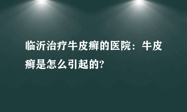 临沂治疗牛皮癣的医院：牛皮癣是怎么引起的?