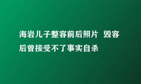 海岩儿子整容前后照片  毁容后曾接受不了事实自杀